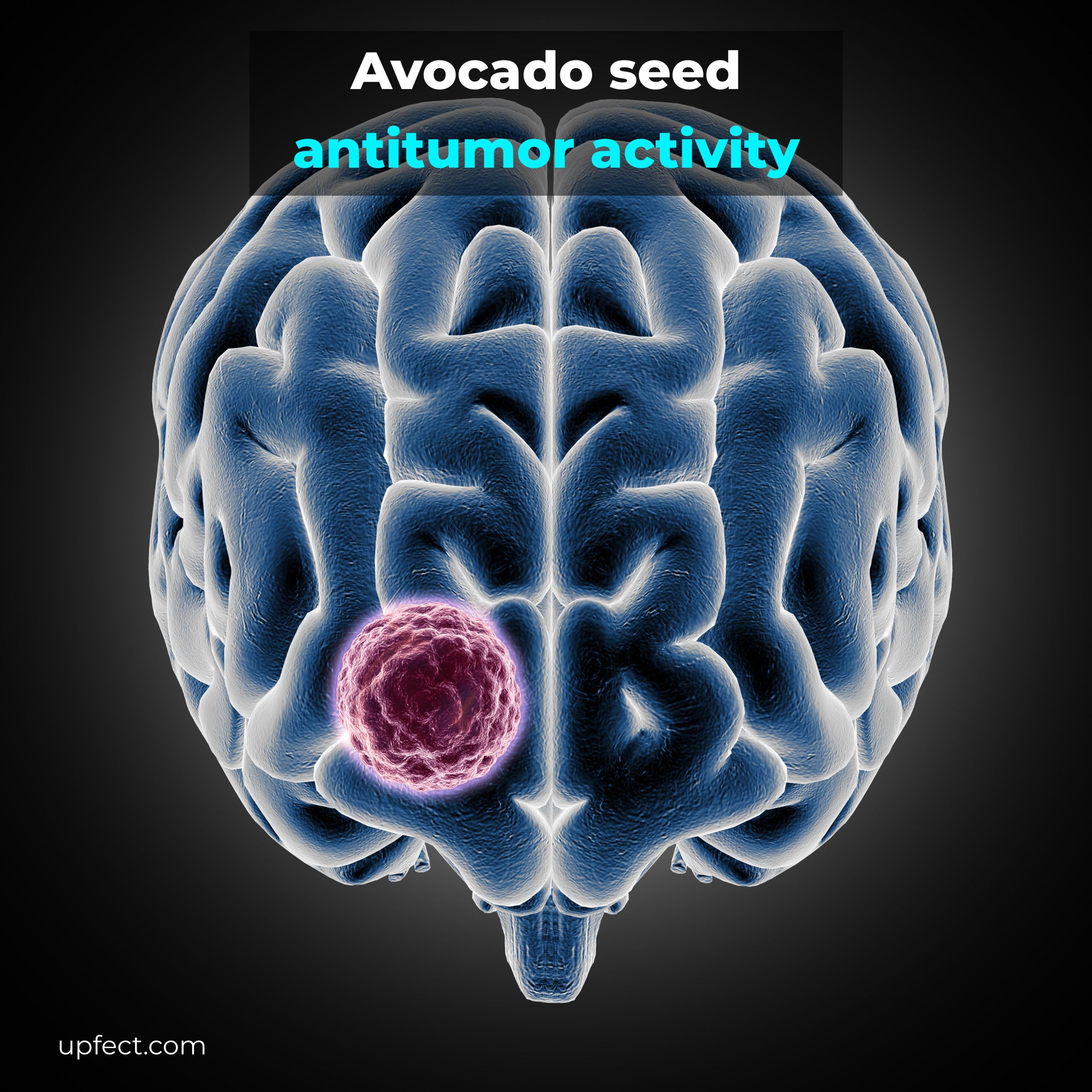 Avocado Seed Antitumor Activity